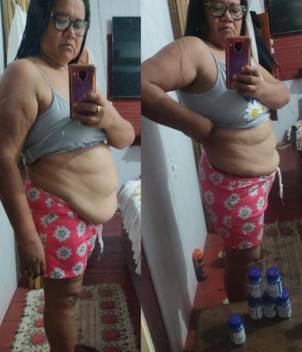 Foto real de cliente OzenVitta